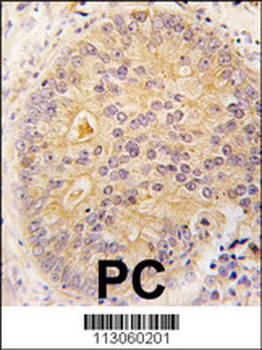 CAMKK2 Antibody (N-term G67)