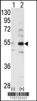 ALS2CR2 Antibody (C-term L289)