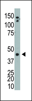 ADK Antibody (N-term)