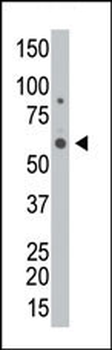 GALK2 Antibody (C-term)