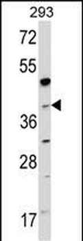 NAGK Antibody (C-term)