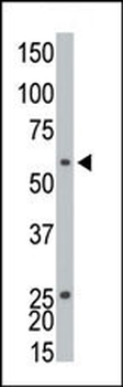 Ethanolamine Kinase (EKI1) Antibody (C-term)