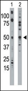 Ethanolamine Kinase (EKI1) Antibody (N-term)