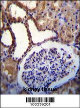 WNK3 (PRKWNK3) Antibody (C-term)