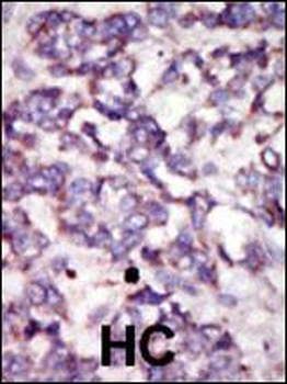 PDK2 Antibody (C-term)
