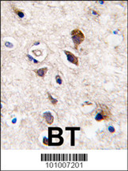 PKC gamma Antibody (C-term)