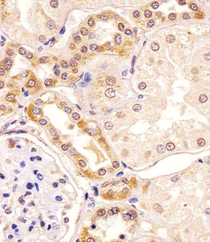PKC beta1/2 Antibody (Center)