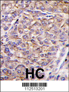 JIK (TAOK3) Antibody (C-term)