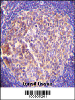 GRK6 Antibody (C-term)