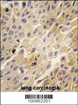 ADRBK1 Antibody (C-term)