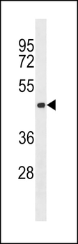 Aurora-C Antibody (Center)