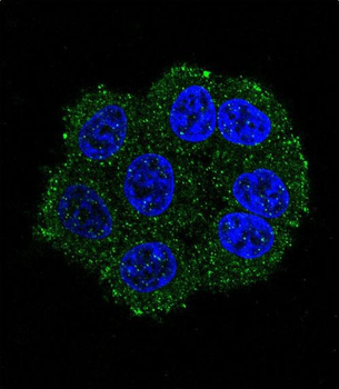 TMPRSS3 Antibody (Center)