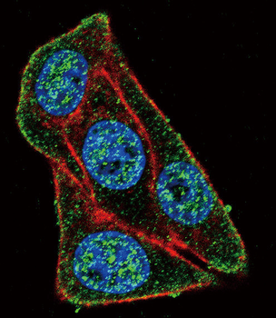 PAX6-T373 Antibody