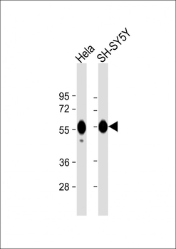 CALR Antibody