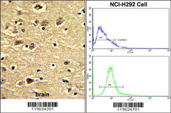 ENTH Antibody (Center)