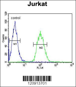 ALAD Antibody (C-term)