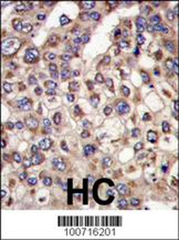 MTMR4 Antibody (C-term)