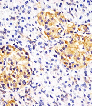 Hsp 60 Antibody (N-term)