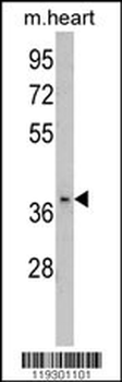FBP2 Antibody (C-term)