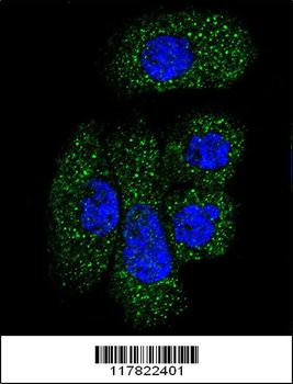 SERPING1 Antibody (Center)