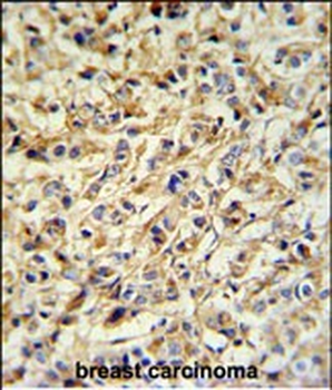 PRELP Antibody (Center)