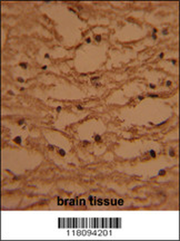 HTATSF1 Antibody (N-term)