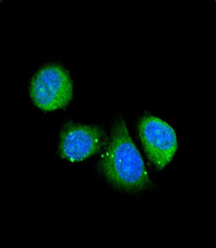 ASPN Antibody (Center)