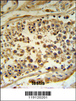 HFE Antibody (Center)