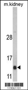 DNAJC19 Antibody (Center)