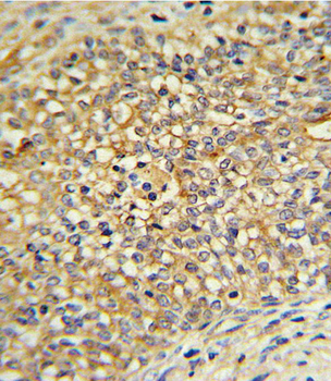 UDB17 Antibody (Center)