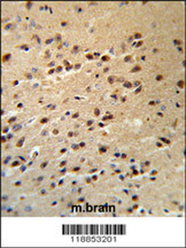 ALS2 Antibody (C-term)