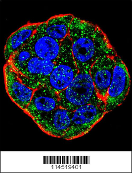 FGF1 Antibody (N-term)