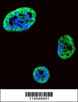 HDGF Antibody (C-term)