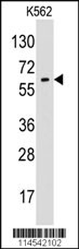 Glypican 6 (GPC6) Antibody (N-term)