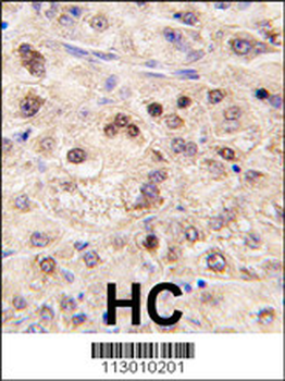 ZBTB7B Antibody (Center)