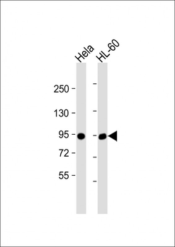 IL3RB Antibody (C-term V759)