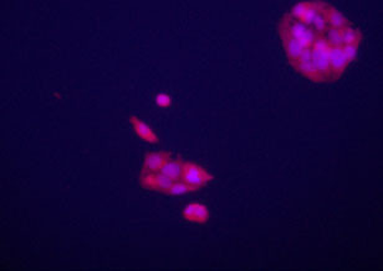 Glypican 3 (GPC3) Antibody (C-term)