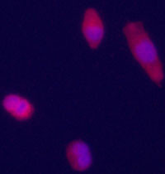 Glypican 3 (GPC3) Antibody (Center)