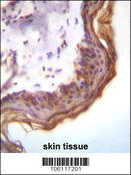 Kallikrein 7 Antibody (Center)