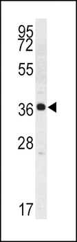 Kallikrein 2 (KLK2) Antibody (C-term)