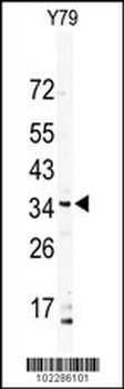 DSCR3 Antibody (N-term)