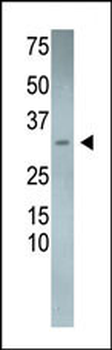 Calcipressin 3 (DSCR1L2) Antibody (N-term)