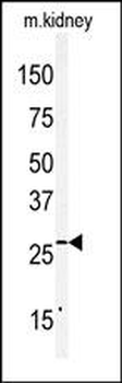 Claudin 2 (CLDN2) Antibody (C-term)