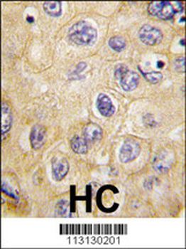 Claudin 1 (CLDN1) Antibody (Loop1)