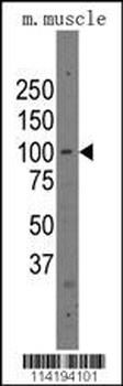 Parp12 Antibody (C-term)