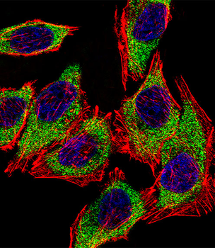 Anterior Gradient 2 (AGR2) Antibody (N-term)