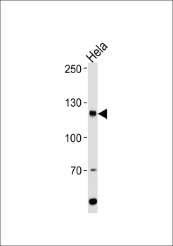 HIRA Antibody (Center)