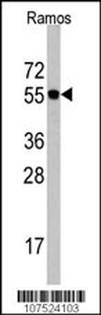 Cdc6 Antibody (N-term)