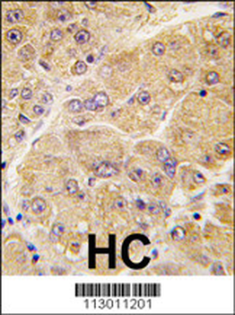 SOST Antibody (Center)