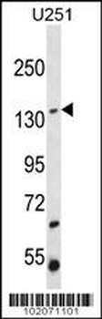 ST5 Antibody (C-term)
